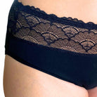 menstrosa spets närbild